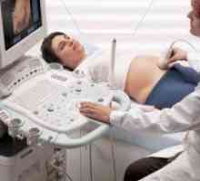 33 Tjedna trudnoće: ultrazvuk
