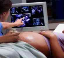 34 Tjedna trudnoće: težina fetusa