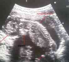 35 Tjedna trudnoće: uterusa ton