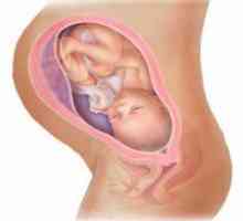 35 Tjedna trudna: karlične prezentacija