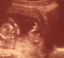 8 Tjedana trudnoće