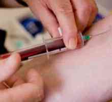 A test krvi za hepatitis