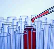 Krv testovi za hormone štitnjače
