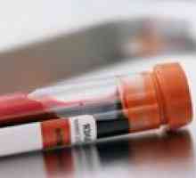 Test krvi za hormone