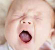 Bijele jezik u dojenčadi