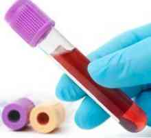 Cdat testovi za hepatitis