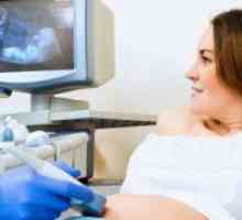 Ono što se može vidjeti na ultrazvuku u 32 tjedana trudnoće?