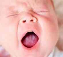 Ono što treba da znate o novorođenčeta usta?