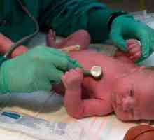 Ono što je gušenje u novorođenčadi i kako ga liječiti
