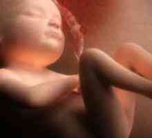 Fetometry fetus 32 tjedna