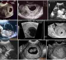 Foto by sedmica trudnoće ultrazvukom