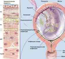 Kako izliječiti mikoplazmoze u trudnoći