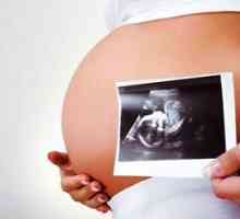 Kako prepoznati Down sindrom u trudnoći
