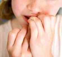 Kako odviknuti dijete grize nokte