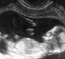 Kao fetus u razvoju u 16 tjedna trudna?