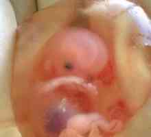 Kao fetus razvija u 9 sedmica trudnoće?