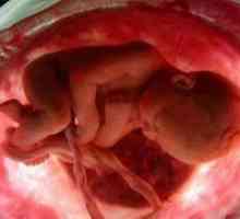Kako se fetus na 25 tjedna trudnoće?
