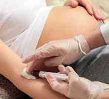 Koje testove je potrebno za vrijeme trudnoće