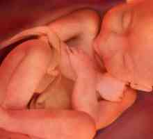 Koliki fetus na 25 tjedna trudnoće