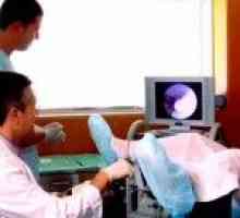 Kolposkopija: priprema, ponašanja. kolposkopija sigurnost u trudnoći