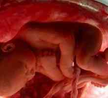Smeđe pražnjenje tokom trudnoće