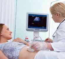 U kom periodu će trudnoće ultrazvuk