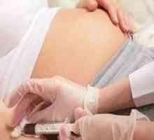 Protiv bolova prilikom porođaja