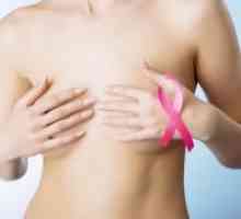 Tumora dojke kod žena - Simptomi