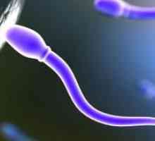 Pokretljivost spermatozoida