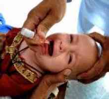 Polio u djece - užasnog naslijeđa prošlosti stoljeća.