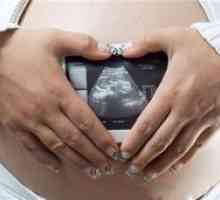 Malformacije fetusa: uzroci, vrste i dijagnoza