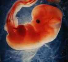 Razlozi za trudnoću u razvoju