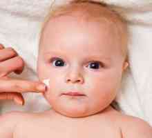 Uzroci suhe kože kod beba
