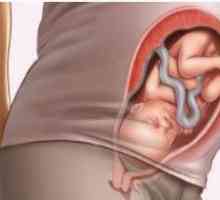 Razlozi za debljanje u 34. tjednu trudnoće