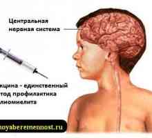 Vakcinacija protiv dječje paralize
