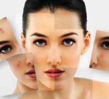 Problem kože: 7 popularne zablude o aknama