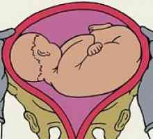 Uzdužni položaj fetusa