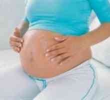 Prevencija strija u trudnoći