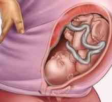 Lokacija fetusa tokom trudnoće