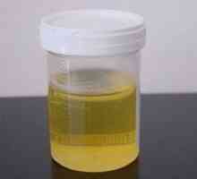 Dešifrovanju analiza urina kod djece
