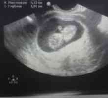 Beba 10 sedmica trudna, 10 tjedana trudnoće - razvijanje