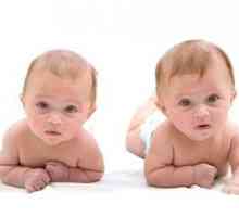 Rođenje blizanaca: Šta treba da znate