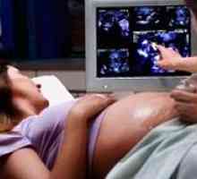 Otkucaj srca fetusa tokom trudnoće