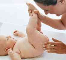 Ljuštenje kože kod novorođenčadi