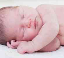 Piling kože kod beba: tela i glave