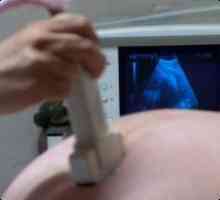 Koliko puta ultrazvuk u trudnoći?