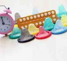 Moderne metode kontracepcije: šta odabrati?