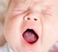 Stomatitis u novorođenčadi: simptomi, liječenje