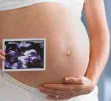 Ultrazvuk fetusa: 37 tjedna