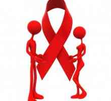 HIV-a i AIDS-a - Simptomi i tretman